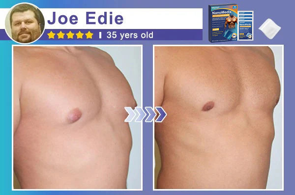 🔥Limited-time 50% sale🔥Yagoo® Chest Fatburn & Firm Patch-Transdermal Lipolysis: Engineered for the Male Physique.