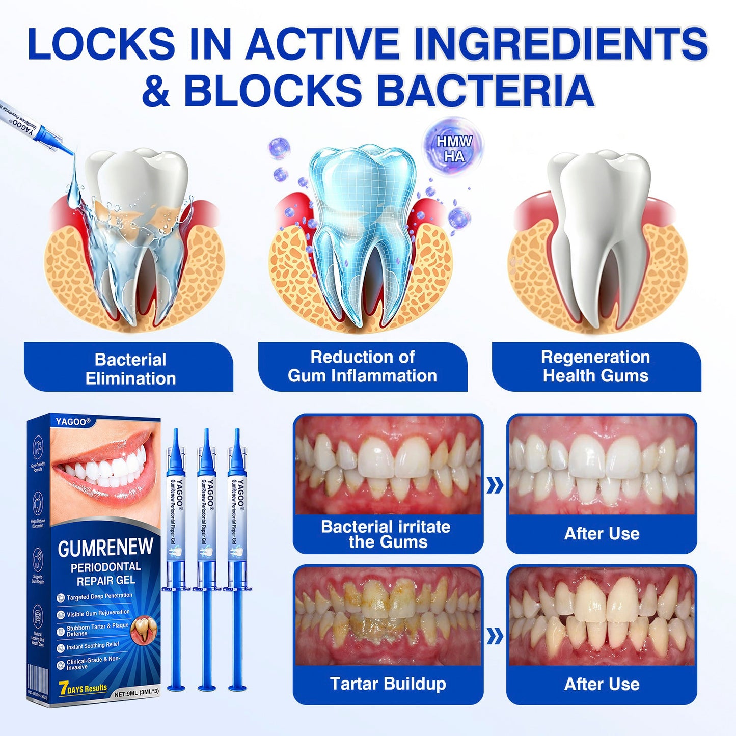 🏅 Advanced Targeted Gel for Periodontal Regeneration Treatment 🦷
