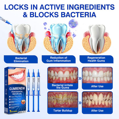 🏅 Advanced Targeted Gel for Periodontal Regeneration Treatment 🦷