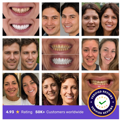 YAGOO™ Teeth Whitening Tablets - Get a Hollywood Smile in 7 Days